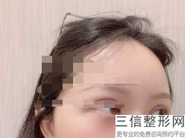 重庆双眼皮医院排名,2022重庆西南医院整形外科实力非凡