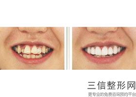 重庆牙齿矫正医院排行前十推荐表待查收,2022重庆美奥口腔医院位列前十