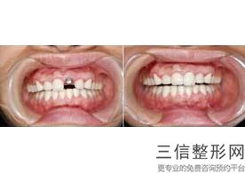 重庆牙科医院哪家好又便宜,2022重庆牙博士口腔医院锁定前十