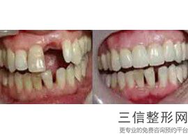 重庆牙科整形医院排行榜前五强人气介绍,2022 重庆美奥口腔医院首次上榜