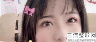 重庆眼科医院排名前五,2022重庆市梁平区人民医院眼科实力超强