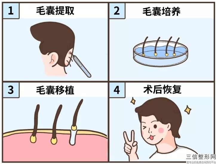 重庆植发医院排行榜新出,2022重庆植发医院价格表实力入围