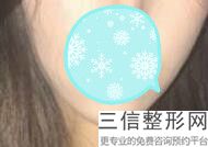 重庆嘴唇整形医院排名榜六强盘点,2022 重庆勤天医疗美容诊所实力非凡