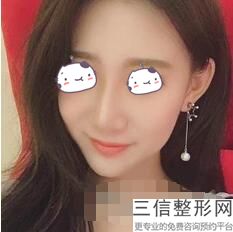 重庆良好的隆鼻整形医院排名,2022重庆联合丽格整形医院遥遥领先