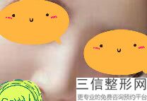 重庆做鼻子哪里好,2022重庆艺星医疗美容医院排名靠前