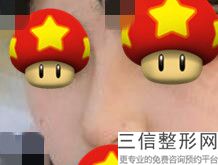 重庆做鼻子求推荐医院,2022重庆华美整形医院实力超强