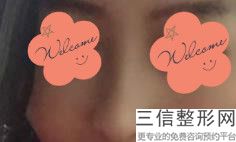 重庆做鼻子医生排名榜有杜亚旭,2022 【彭绍宗】主任医师实力入围