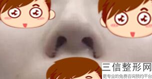 重庆做鼻子整形医院排名,2022重庆叶子医疗美容医院口碑良好