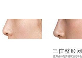 重庆做隆鼻哪家医院好,2022重庆军科整形美容医院位列前十