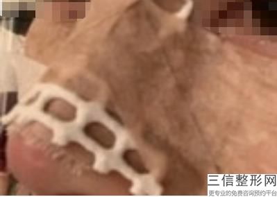 重庆做隆鼻哪家医院靠谱,2022重庆晶肤医疗美容医院首次上榜