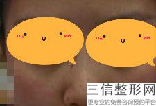 重庆做隆鼻医院哪家好,2022重庆时光整形医院锁定前十