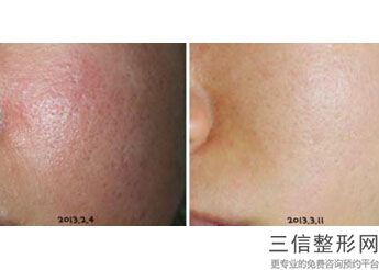 珠海热玛吉官网授权医院排行实时更新,2022珠海韩妃医疗美容医院不容错过