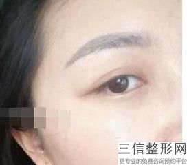 珠海双眼皮医院哪里好,2022珠海莱茵医疗美容门诊部位列前十