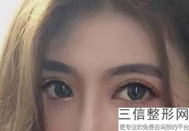 珠海双眼皮医院排行榜上线,2022珠海科美医疗美容门诊部实力上榜