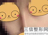 珠海整形隆鼻哪里好,2022珠海韩妃医疗美容门诊排名靠前