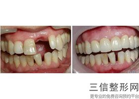 自贡市牙科医院哪家更好,2022自贡市第四人民医院整形科遥遥领先