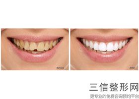 西安口腔医院排行,2022西安雁塔瑞泰口腔医院实力上榜
