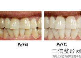 西安口腔医院排名前十哪家好,2022西安美奥口腔医院实力非凡