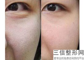 西安拉皮手术医院哪家好,2022西安画美医疗美容医院排名靠前