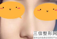 西安隆鼻有名的医生排名榜,2022金磊医生实力入围