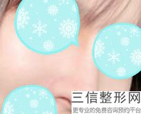 西安哪家整形医院做鼻部手术好,2022 高一生医疗美容医院不容错过