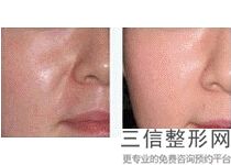 西安热玛吉官方认证医院排行榜前三正规有资质,2022西安画美医院不容错过