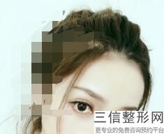 西安十大眼科医院排名,2022西安交大附属二院口碑良好