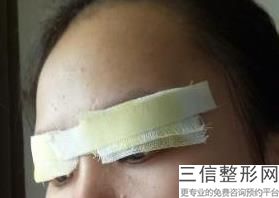 西安眼综合整形医院排行榜,2022西安光仁丁医生整形中心实力入围