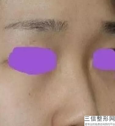 天津隆鼻医生排名前十,2022刘光晶医生实力超强