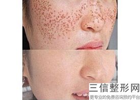 天津皮肤整形外科医院排名榜前五揭晓,2022天津大学新城医院实力上榜