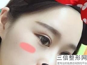天津有名气的双眼皮医生排名前八,2022王小强医生实力非凡