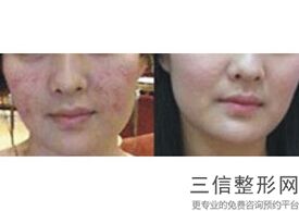 天津做拉皮手术哪家好,2022天津美莱医疗美容医院不容错过