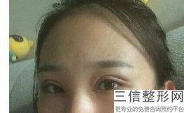 铜陵双眼皮整形医院排行榜,2022铜陵博爱医院美容科实力入围