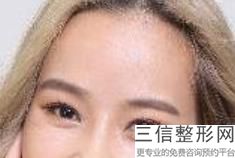推荐下南京做双眼皮好的医院,2022南京美贝尔美容整形医院遥遥领先