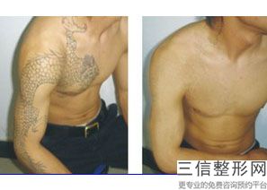 潍坊热玛吉认证机构查询,2022潍坊医学院整形外科医院实力入围