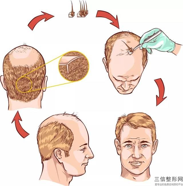 潍坊植发哪个医院好,2022潍坊坤娜整形实力入围