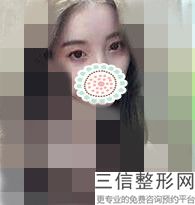 温州割双眼皮整形医院排名前五,2022温州伯思立医院遥遥领先