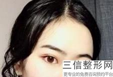 温州割眼袋哪家医院好,2022温州割眼袋哪家医院好排名如下实力入围