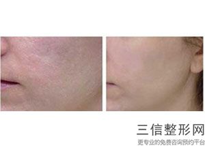 温州拉皮哪家医院好,2022温州乐清芘丽芙医院实力入围