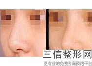 温州隆鼻哪家医院较好,2022温州名人医疗美容门诊部首次上榜