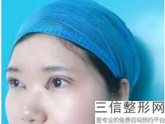 温州双眼皮整形医院排名前十集结,2022温州和平整形医院遥遥领先