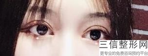 温州眼科医院排名榜深度盘点,2022温州医科大学附属第二医院实力超强
