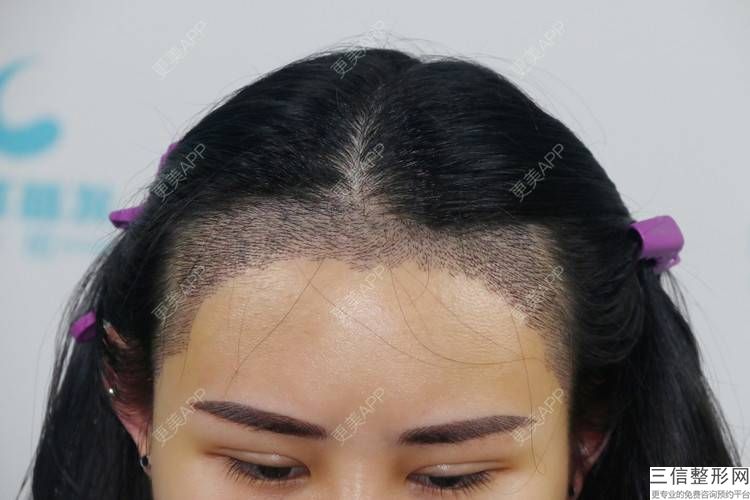温州植发整形医院排名前十有哪些,2022温州艺星医学美容院实力上榜