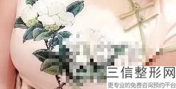 乌鲁木齐假体隆胸医生排行榜前五强,2022吴新民医生遥遥领先
