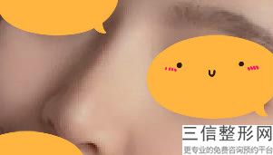 乌鲁木齐隆鼻整形美容医院排名前十,2022新疆黎美医疗美容实力入围