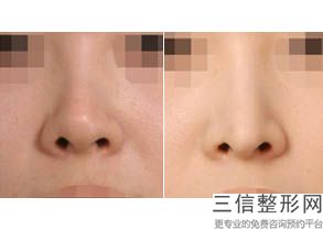 上海九院哪位医生做鼻子好,2022戴传昌不容错过