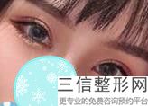 上海九院双眼皮修复专家排名榜,2022刘菲副主任医生遥遥领先