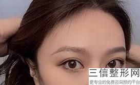 上海九院双眼皮医生排行榜前十,2022范先群实力上榜