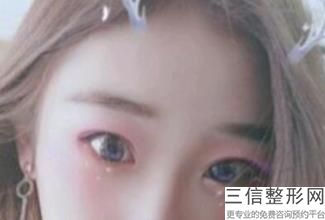 上海九院眼部整形医生哪个好,2022 张余光医生排名靠前