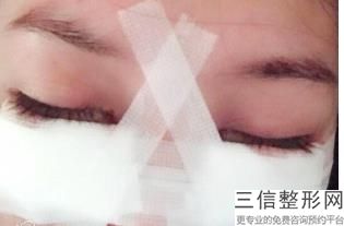上海九院眼科整形专家排名前十,2022黄筱琳口碑良好